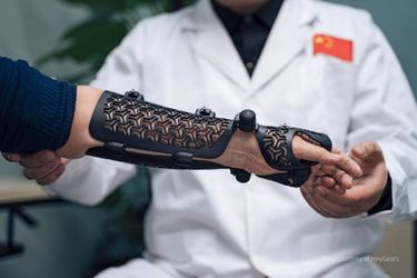 Arm Orthosis