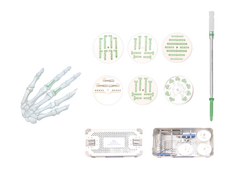 TML Micro Locking Plate System