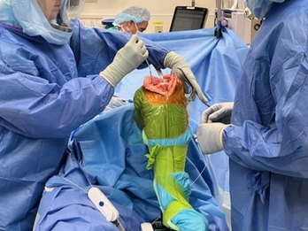 No assist TKA in the ASC Dr. Robert Jamieson