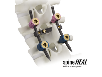 spineHEAL Pedicle Screw System