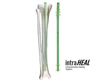 intraHEAL Intramedullary Nailing System