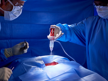 TISSEEL Fibrin Sealant