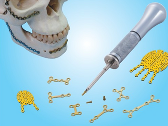 Craniomaxillofacial System