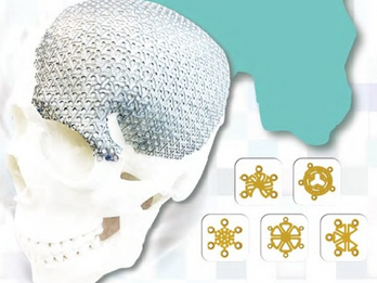 Neurosurgery System