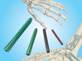 Cannulated Screw System