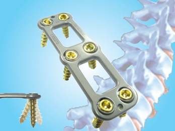 Cervicle System