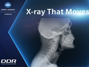 Dynamic Digital Radiography (DDR) is X-ray That Moves!