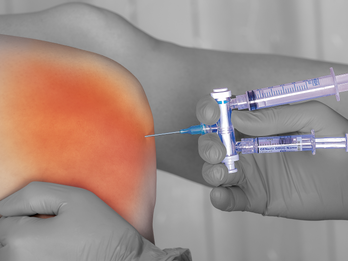 A-Tap™ for intra-articular injections
