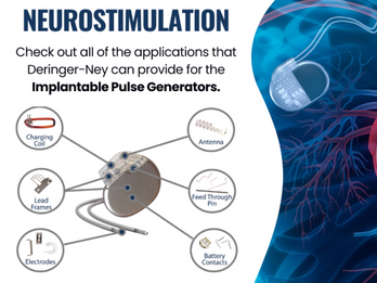 Deringer-Ney: Neurostimulation